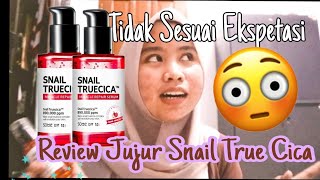 Review jujur SOME BY MI Snail True Cica Repair Serum di Acne Prone Skin [upl. by Sirenay770]