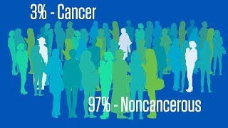 Understanding CA125 Screening for Ovarian Cancer [upl. by Adlev]