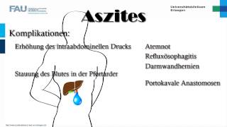 Innere Medizin ─ Aszites [upl. by Parfitt543]