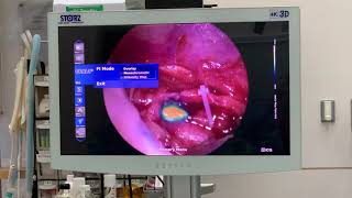 MIS thoracic duct ligation of a dog with chylothorax by Karl Storz IMAGE1 S™ Rubina™ 4K system [upl. by Wolfson214]