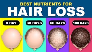 Hair fall Treatment  Hair Loss Treatment for Men  How to stop hair fall  Hair RegrowthNUTRIENTS [upl. by Assirrec]