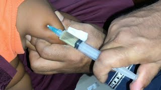 Ceftriaxone 500mg Ceftrone  amp Dexamethasone intramuscular injection Video 24 Ep 75 Injection Tips [upl. by Janis64]