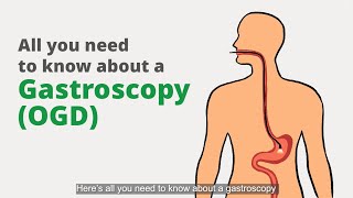 Gastroscopy OGD What is it for and what should I expect [upl. by Pellet629]