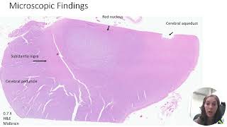 Neuropathology  Part 1 [upl. by Lochner]