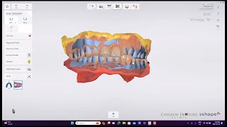 Reference Denture Intraoral Scans [upl. by Carlee750]