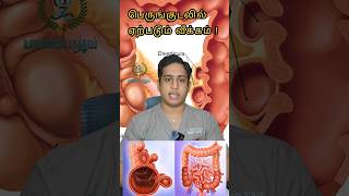 பெருங்குடலில் ஏற்படும் வீக்கம்Diverticulitis treatmentDiverticulitis symptoms diverticulitis gut [upl. by Koralle]