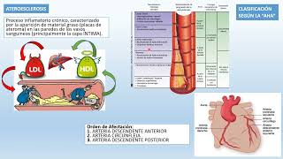 ❤❤Resumen completo de CARDIOPATIA ISQUÉMICA  ANGINA  INFARTO AGUDO MIOCARDIO IAM [upl. by Dareen]