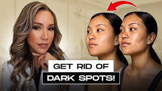 Say Goodbye to Dark Spots Dermatologist Tips for Flawless Skin [upl. by Karita]