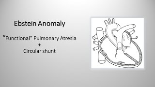 Ebstein anomaly quotfunctionalquot pulmonary atresia and quotcircularquot shunt [upl. by Amari]