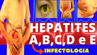 HEPATITES A B C D e E  CARACTERÍSTICAS SINTOMAS DIAGNÓSTICO E TRATAMENTO  INFECTOLOGIA [upl. by Cosette]