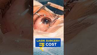 LASIK Surgery Cost [upl. by Emmons]