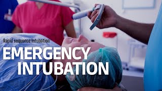 Emergency Intubation RSI in ER step by step approach [upl. by Jo Ann]