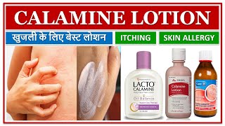 CALAMINE LOTION खुजली के लिए बेस्ट लोशन ITCHING SKIN ALLERGY INSECT BITES ECZEMA SKIN LOTION [upl. by Francene815]