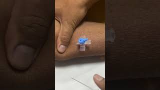 IV cannula insertiondocternursingmotivationviralvideoshortvideo [upl. by Oicapot515]