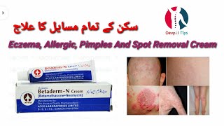 Betaderm N cream benefits uses side effects Urdu and Hindi [upl. by Canice]