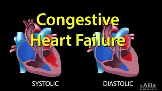 Systolic vs Diastolic Heart Failure  Heart Failure Part 2 [upl. by Mcnally]