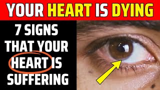 5 Warning Signs Your Heart Is in Serious Danger [upl. by Ocsic]