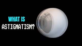 Astigmatism explained [upl. by Yelkcub]