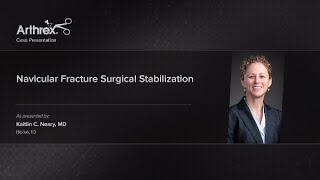 Navicular Fracture Surgical Stabilization [upl. by Ecnar]