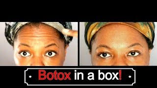 Botox in a Box Loreal Bright Reveal Review Wrinkle Treatment [upl. by Nemracledairam]