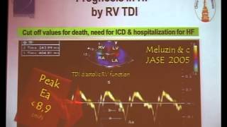 Gheorghe Cerin Perioperative echocardiography of the right ventricle [upl. by Beitris]