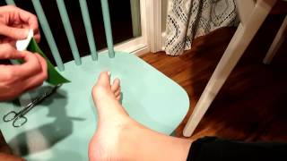 Pain in the big toe joint treatment of sprain and sesamoid injury with taping [upl. by Norted]