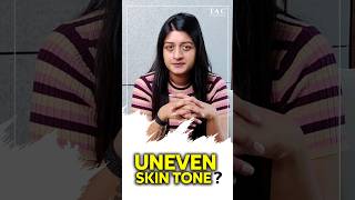 Uneven skin tone  Causes  Treatment [upl. by Anadal]