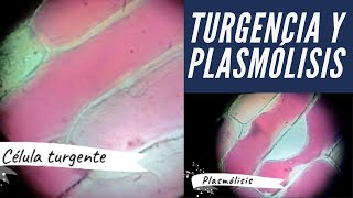 Turgencia y plasmólisis Soluciones hipotónicas hipertónicas e isotónicas [upl. by Jenn999]