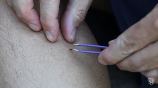 Mayo Clinic Minute Tips to best remove ticks [upl. by Sedda527]