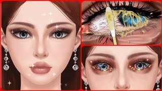 ASMR Eye stones removal amp Eyelid sebum extrusion  Eyelash treatment animation [upl. by Delanie339]