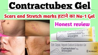 Contractubex Gel। contractubex gel uses in hindi। acne scars removal gel। get relief scars quickly। [upl. by Noiraa]