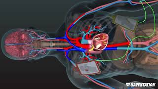 AED in Action  A 3D look inside the body [upl. by Lanod]