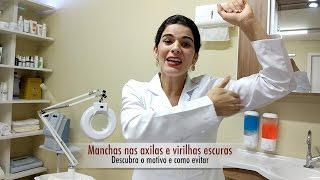 Como evitar manchas nas axilas e virilha escura Patricia Elias [upl. by Eenafets]