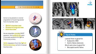 Comprehensive Guide to Fetal Echocardiography of the Fetal Aorta [upl. by Koch501]