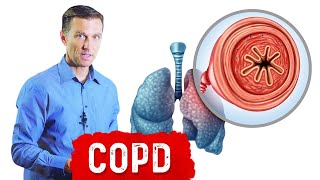 Chronic Obstructive Pulmonary Disease COPD [upl. by Castera]