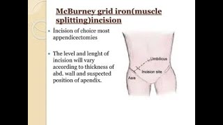 Muscle splitting incision  Mcburney Grid iron Incision during appendectomy [upl. by Ez]