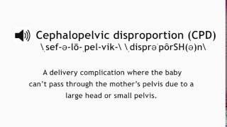 How to Pronounce Cephalopelvic Disproportion CPD [upl. by Wehttam]