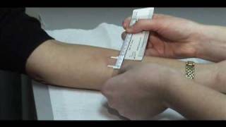 TB Skin Test  Mantoux Method [upl. by Laurentium]