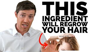 The BEST Hair Supplements Contain This Ingredient [upl. by Teillo]