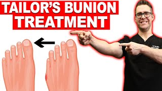 1 Tailors Bunion amp Bunionette Treatment Correctors Surgery [upl. by Eppilihp]