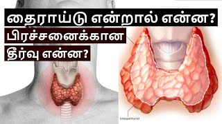 What is Thyroid in Tamil  Types of Thyroid  Thyroid Symptoms [upl. by Nevag]