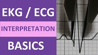 EKGECG Interpretation Basics Nursing NCLEX  QRS Complex P Wave T Wave PR Interval [upl. by Stephens]