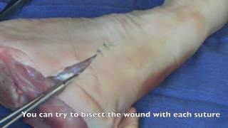 Suture  Basic Technique 2 [upl. by Hamilton]