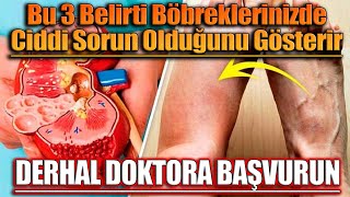 Bu 3 Belirti Böbreklerinizde Ciddi Sorun Olduğunu Gösterir Derhal Doktora Başvurun [upl. by Oecile592]