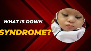 What is down syndrome [upl. by Conchita566]