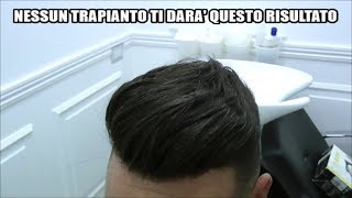 Capelli senza Trapianto RISULTATO GARANTITO [upl. by Eniamret]