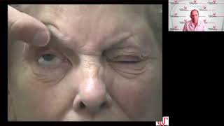 Lecture Approach to the Patient with Double Vision [upl. by Willis]