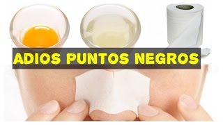 Como remover puntos negros en la nariz  Clara de huevo [upl. by Nodla308]