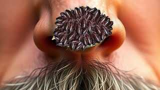 ASMR Trypophobia and Dog Ticks RemoveMost Satisfying  ASMR 2D Animation Treatment [upl. by Alarice]