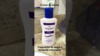 Tratamento de caspa e dermatite seborreica [upl. by Ahsenad849]